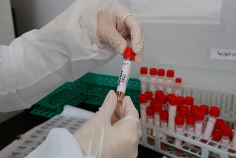 ارتفاع عدد المصابين بفيروس كورونا إلى 263 